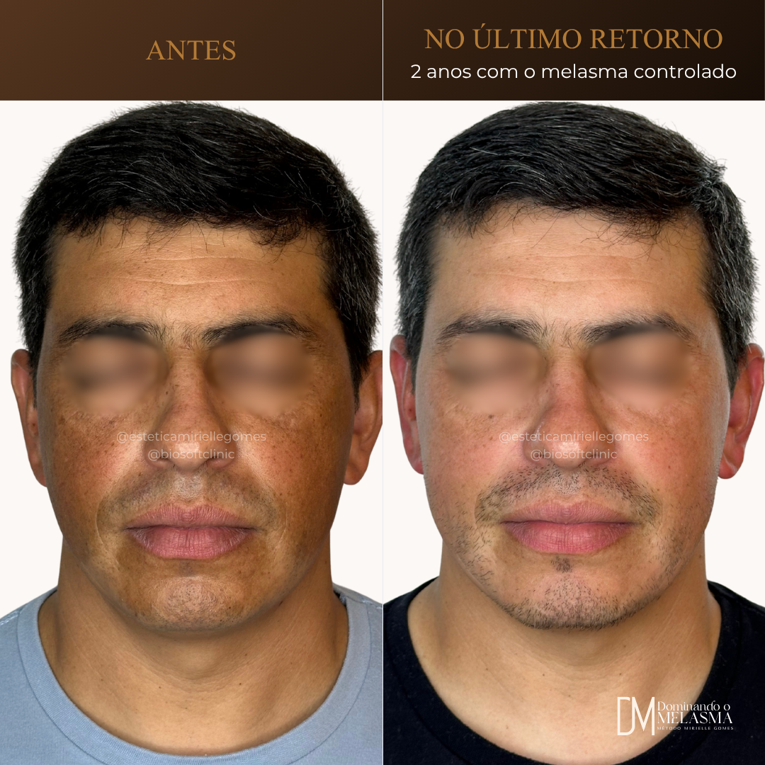 Resultado 8